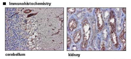 Polyclonal Rabbit anti-Human SLC7A14 Antibody (IHC, WB)
