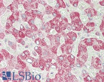 IHC-plus™ PKN2 Antibody (aa200-250)