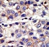 Polyclonal Rabbit anti-Human CBX4 Antibody (aa80-110, IHC, WB)