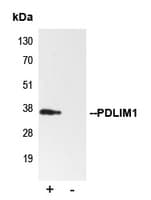 PDLIM1 Antibody (Internal)