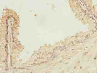 POGZ Antibody