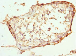 ABCC11 / MRP8 Antibody