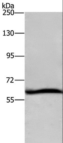 SMIF / DCP1A Antibody