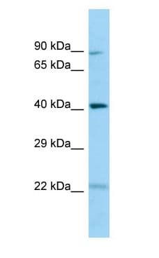 CHID1 Antibody (N-Terminus)