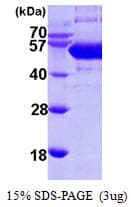 Human SEPSECS Protein (Recombinant His)