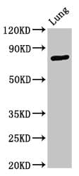 ATXN7 / SCA7 / Ataxin-7 Antibody