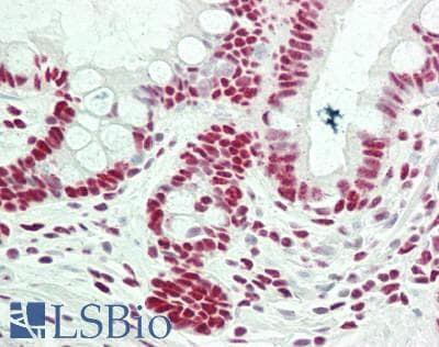IHC-plus™ RBM25 / SNU71 Antibody (aa475-525)