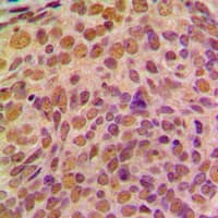 CCNB1 / Cyclin B1 Antibody (Internal)