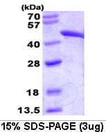 Human FH / Fumarase / MCL Protein (Recombinant)