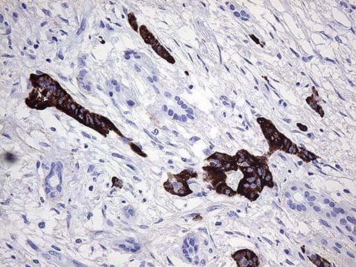 ZRANB1 / TRABID Antibody (aa208-296, clone OTI7A3)