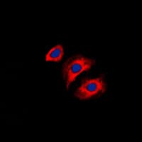 COL3A1 / Collagen III Antibody (N-Terminus)