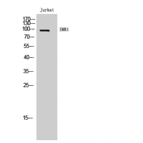 Polyclonal Rabbit anti-Human ADGRE1 / EMR1 Antibody (790-870 aa, C-terminal, WB)