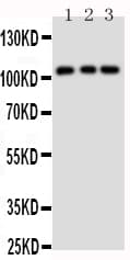 Polyclonal Rabbit anti-Human TRPC6 Antibody (aa249-265, IHC, WB)