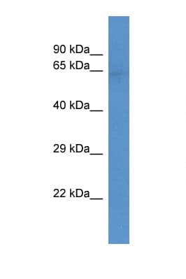 SLC22A3 / OCT3 Antibody (aa100-149)
