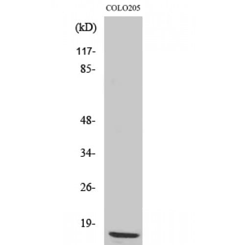 RPL36 / Ribosomal Protein L36 Antibody (30-110 aa, Internal)