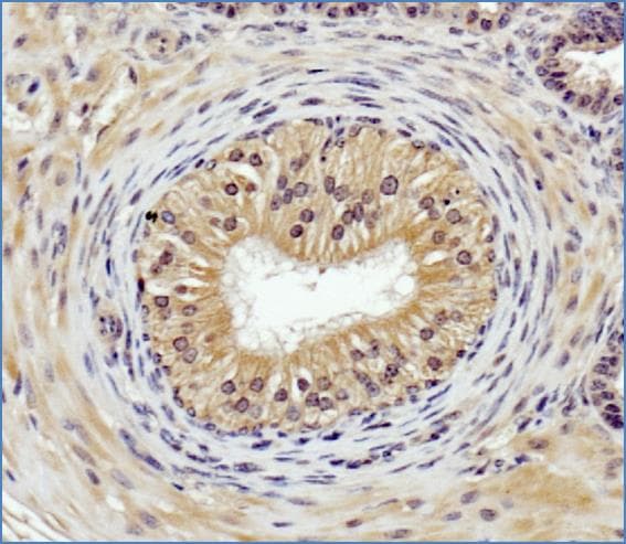 Polyclonal Rabbit anti-Human CTSB / Cathepsin B Antibody (aa200-270, IHC, IF, WB)