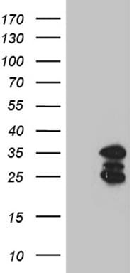 SH3BGR Antibody (clone OTI1G8)