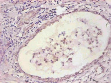Monoclonal Mouse anti-Human IL6 / Interleukin 6 Antibody (WB)