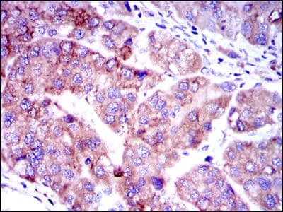 SMAD2 Antibody (clone 5G7)