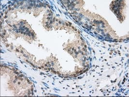 ERCC1 Antibody (clone OTI2A7)