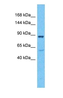 Polyclonal Rabbit anti-Human PKD3 / PRKD3 Antibody (Internal, IHC, WB)