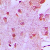MEN1 / Menin Antibody (Internal)