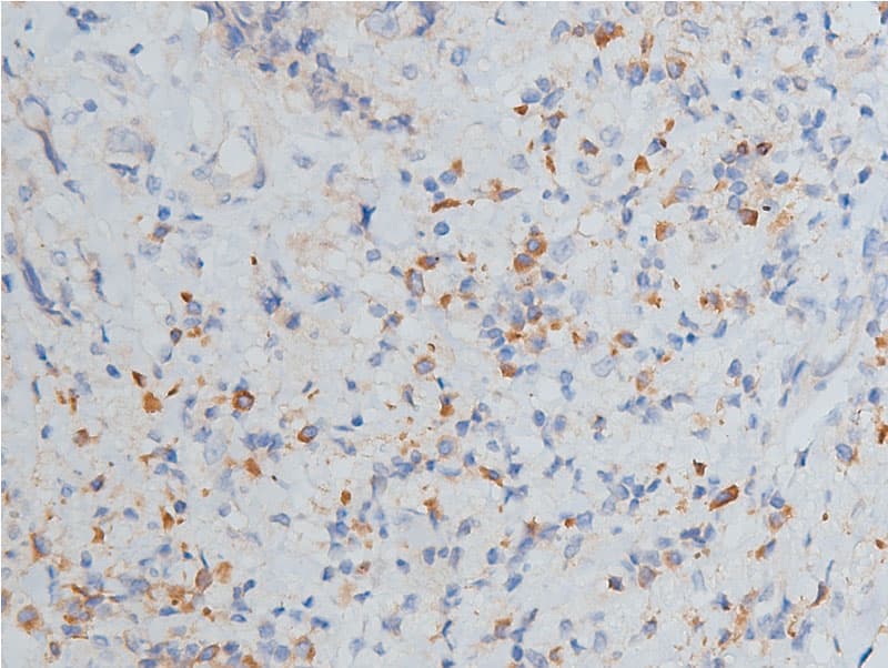 Polyclonal Rabbit anti-Human MMP9 / Gelatinase B Antibody (IHC, IF, WB)