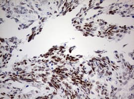 p16INK4a / CDKN2A Antibody (aa25-156, clone OTI1F6)