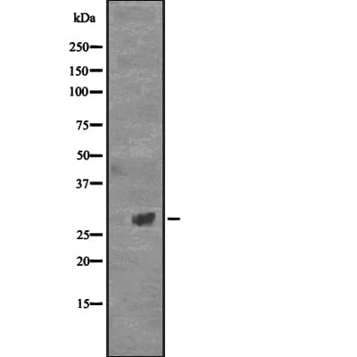 Polyclonal Rabbit anti-Human CD40L Antibody (IHC, WB)