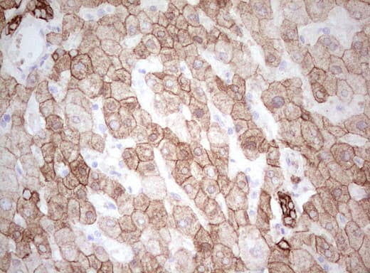 Basic Cytokeratin AE3 Antibody (clone AE3)