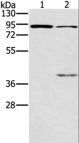 Polyclonal Rabbit anti-Human CNGA3 Antibody (WB)
