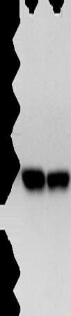 ZFYVE19 Antibody