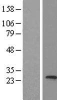 Human MED20 Protein (Over-Expression Lysate Myc-DDK (Flag))