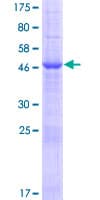 Human METTL21B / FAM119B Protein (Recombinant GST)