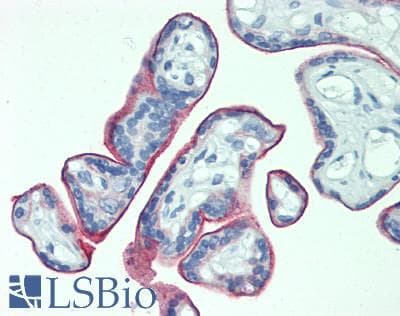 TPBG / 5T4 Antibody (aa32-351)