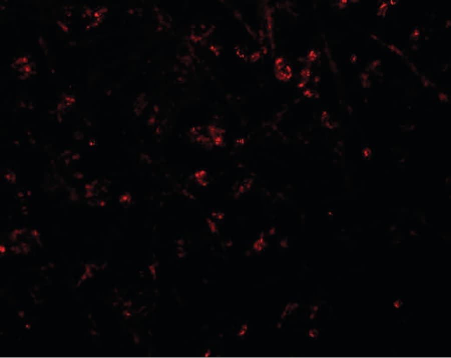 IHC-plus™ Polyclonal Rabbit anti-Human SYNPO / Synaptopodin Antibody (IHC, IF, WB)