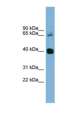 NODAL Antibody (aa35-84)