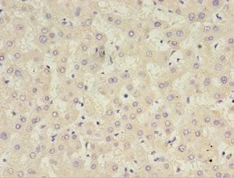 Polyclonal Rabbit anti-Human CFHR2 Antibody (IHC, WB)