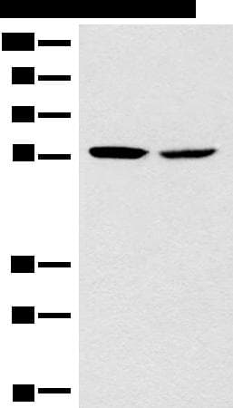 CORO2B Antibody