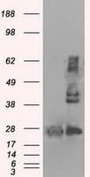 HSD17B10 / HADH2 Antibody (clone OTI5E2)