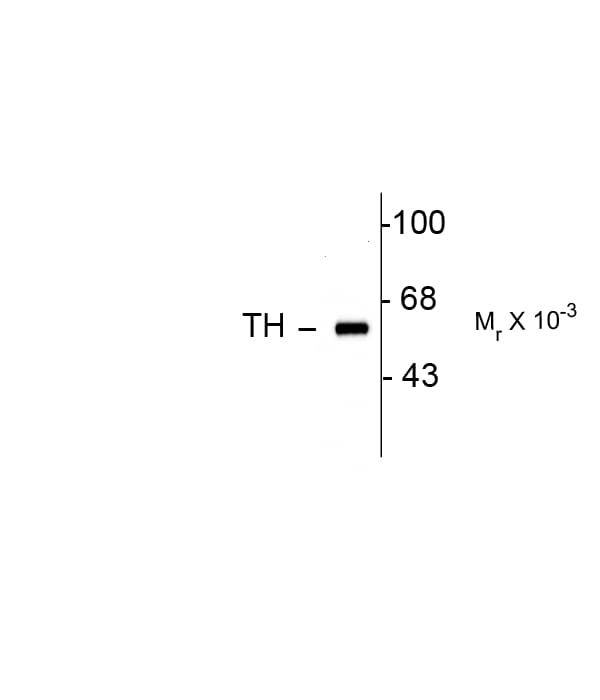 PathPlus™ TH / Tyrosine Hydroxylase Antibody