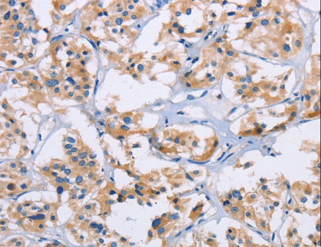 Polyclonal Rabbit anti-Human NKP30 Antibody (IHC)
