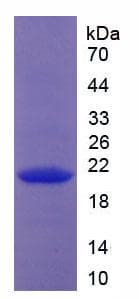 Human Endostatin Protein (Recombinant His-T7)