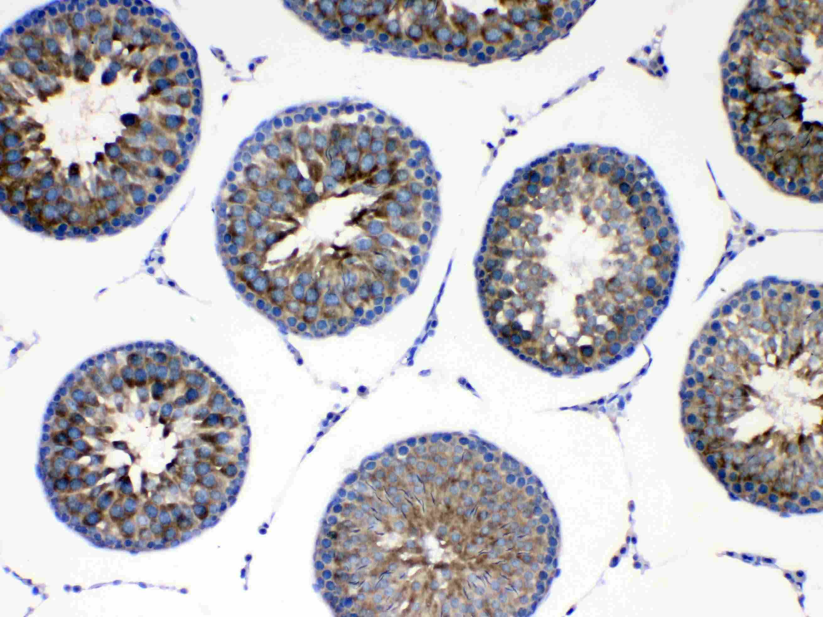 AGRP Antibody