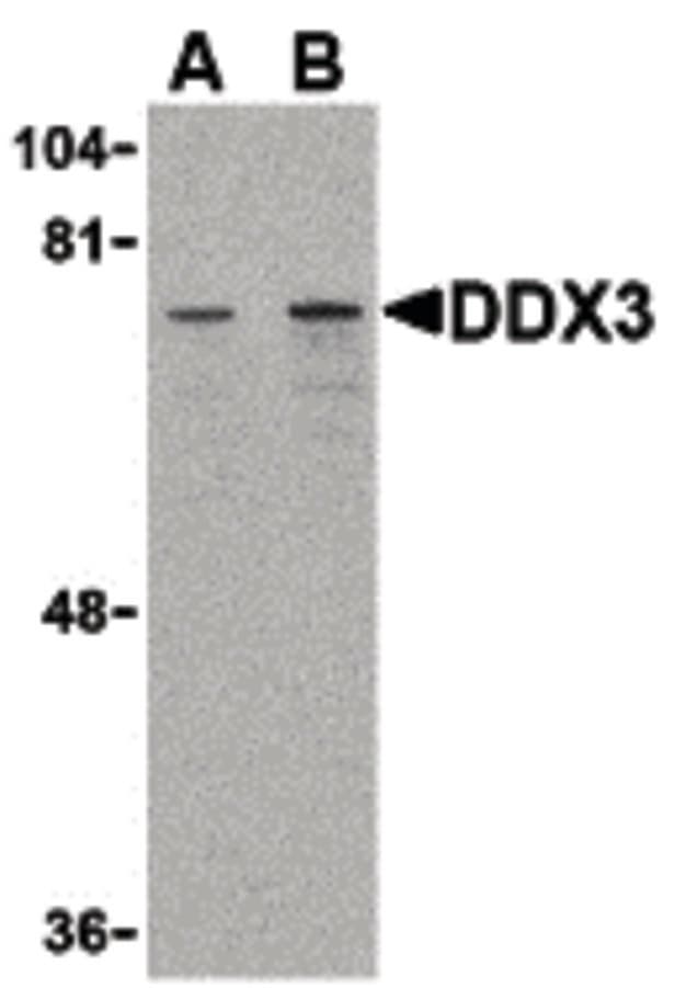 IHC-plus™ Polyclonal Rabbit anti-Human DDX3 / DDX3X Antibody (IHC, WB)