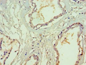SF3B130 / SF3B3 Antibody (aa948-1217)
