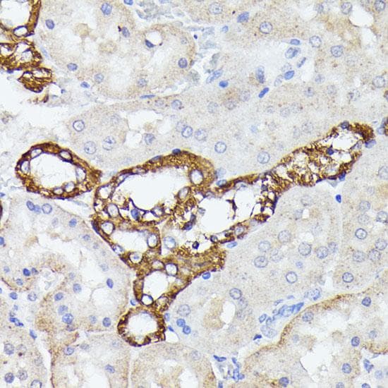 LF / LTF / Lactoferrin Antibody