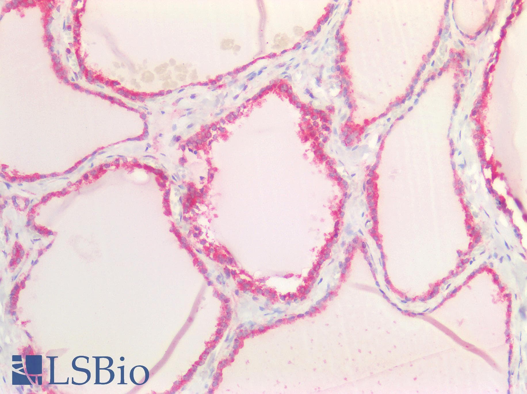 PathPlus™ Polyclonal Rabbit anti-Human CD95 / FAS Antibody (C-Terminus, IHC, WB)