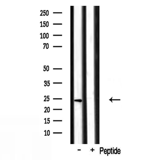 RPL17 / Ribosomal Protein L17 Antibody