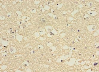 CYP2E1 Antibody (aa49-288)